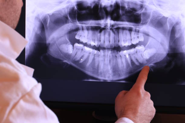 Best Emergency Dental Care for Broken or Chipped Teeth in Rossville, IN